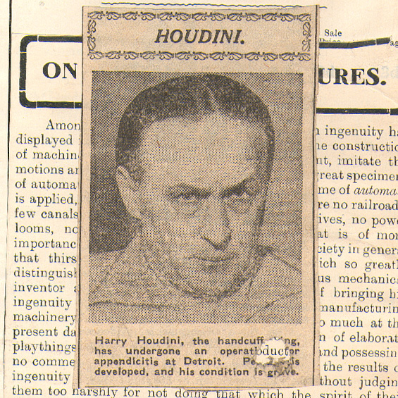 harry houdini undergone opperation